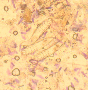 Three demodex mites