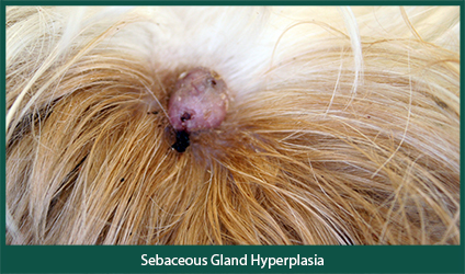 Photo of Sebaceous Gland Hyperplasia
