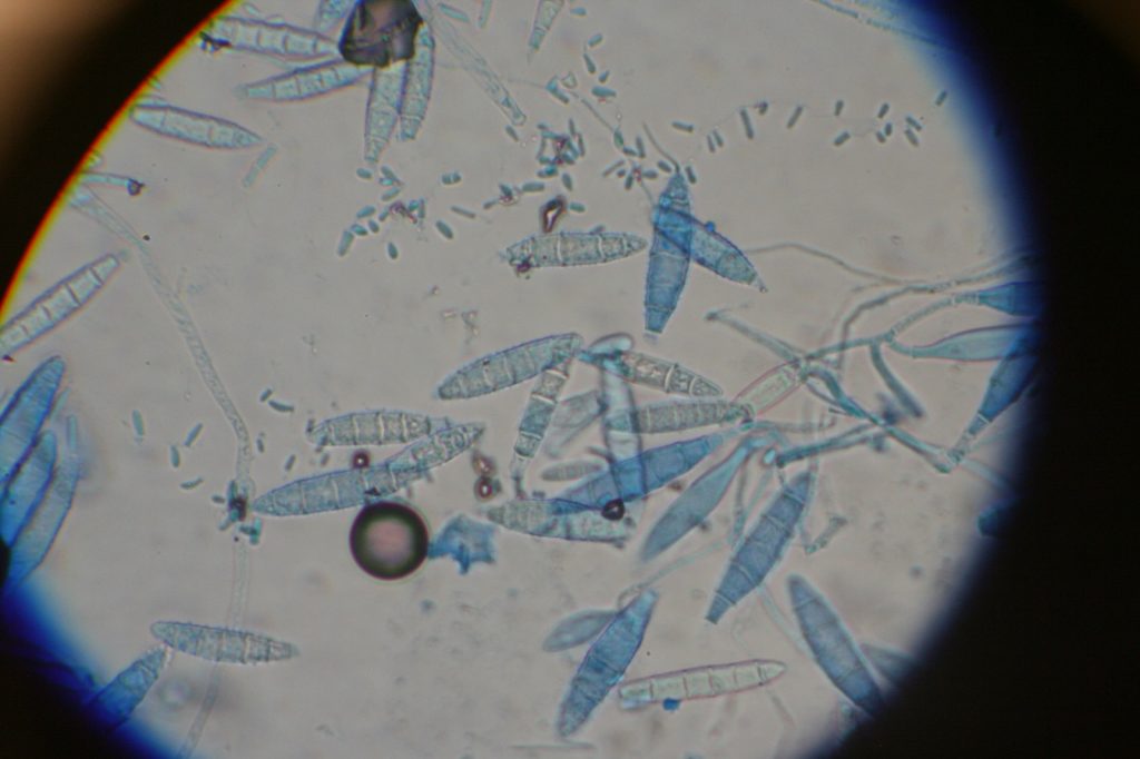 Ringworm Macroconidia Under Microscope